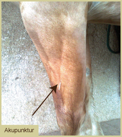 Akupunktur am Bein